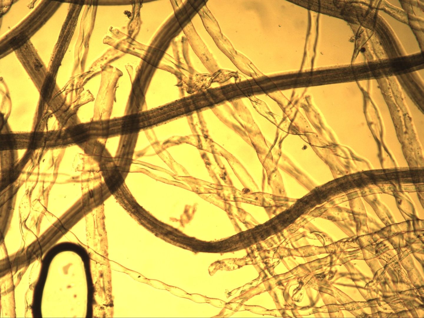 Mikroskopische Ansicht von verschlungenen, durchscheinenden Fasern vor einem warmgelben Hintergrund, die an natürliche Fäden oder Mikroorganismen erinnern.