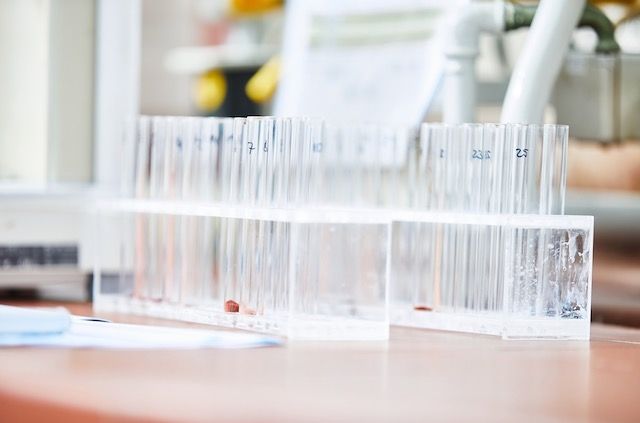 Durchsichtige Reagenzgläser, die in Reihen angeordnet sind und teilweise kleine Partikel enthalten, auf einer Labortischplatte.